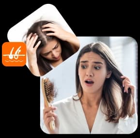 تساقط وضعف الشعر